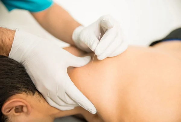 Dry Needling, Cupping and Manual Therapy